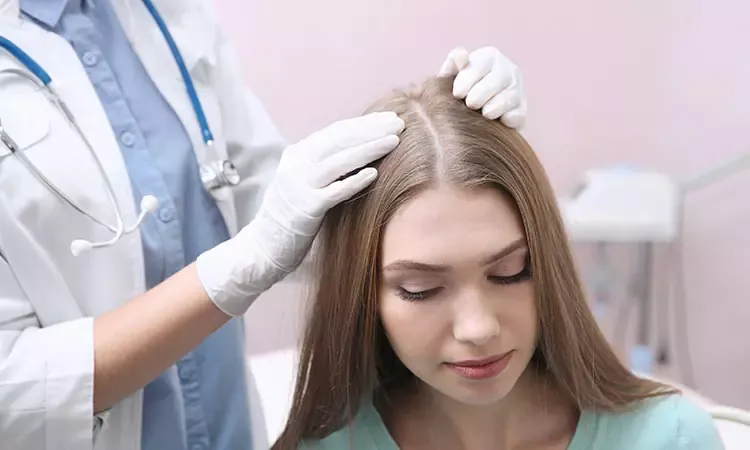 Hair Loss Treatment for Women