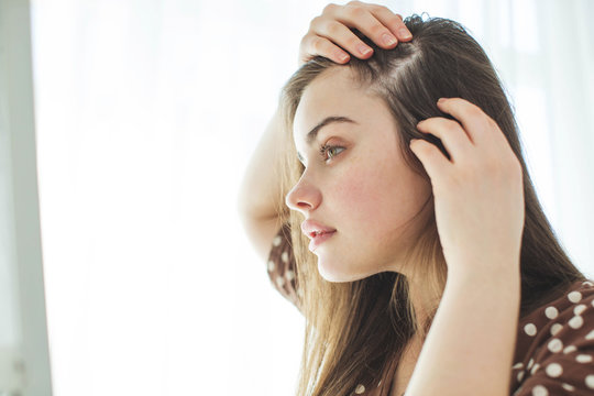 Hair Loss in Teenagers