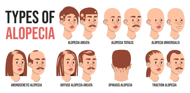 Treatments for alopecia