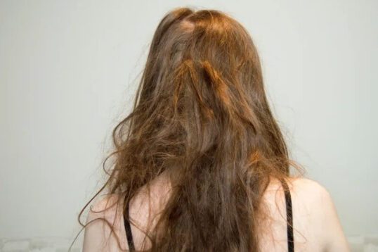 Dry Hair Care Tips for Frizzy Hair