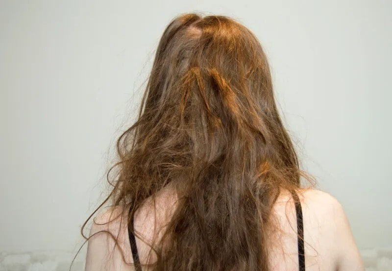 Dry Hair Care Tips for Frizzy Hair