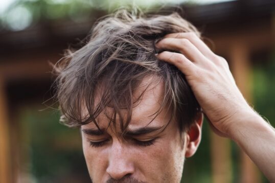 Itching of the Scalp and Hair Loss